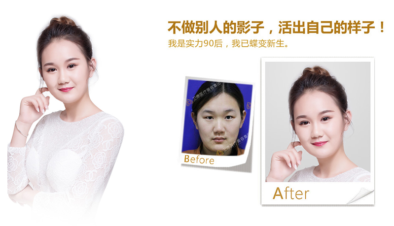 漯河纳米脂肪移植