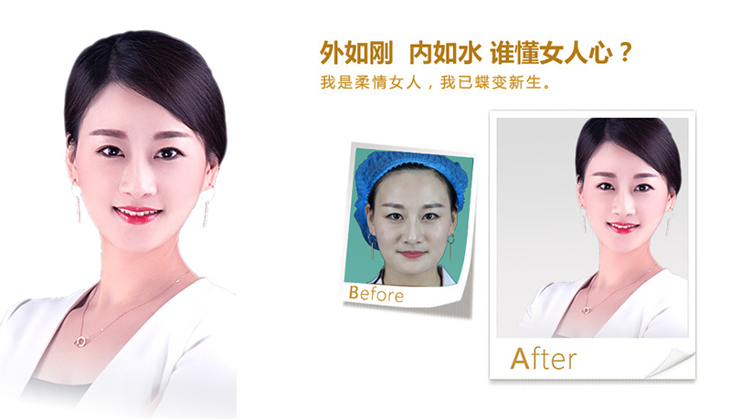 漯河V脸、线雕隆鼻